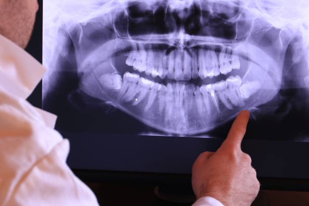 Best Urgent Care for Lost Fillings or Crowns in Thorp, WI