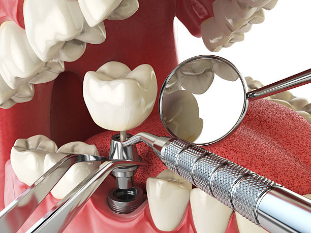 Best Emergency Dental Care for Broken or Chipped Teeth in Thorp, WI